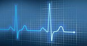 An electrocardiogram (ecg or ekg) records the electrical signal from your heart to check for different heart conditions. Kunstliche Intelligenz Erkennt Neigung Zum Vorhofflimmern Im