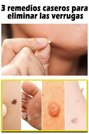 Pin On Remedios