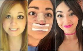 Yosstop arremete contra bárbara de regil. Seis Youtubers Que Se Han Operado Y Lucen Irreconocibles Exa Fm