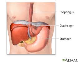 Image result for stomach hernia symptoms
