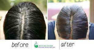Sulfate free hair oil dye free smoothing and nourishing treatment, coconut, hair food, 3.2 fl oz visit the hair food store. Coconut Oil And Lemon Mixture It Turns Gray Hair Back To Its Natural Color Must See Center Henna Hair Dyes Henna Hair Henna Natural Hair