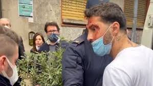 «non vedo fabrizio corona lucido, ci sono momenti in cui perde la cognizione delle cose», questa la confidenza fatta dall'avvocato ivano. Fabrizio Corona Il Tribunale Di Sorveglianza Di Milano Difende La Scelta Di Rimandarlo In Carcere