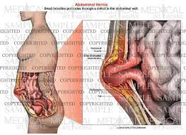 We did not find results for: Female Anatomy Of The Abdomen Anatomy Drawing Diagram