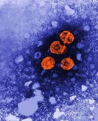 The others are hepatitis a, c, d, and e. Impfung Konnte Chronische Hepatitis B Heilen Healthcare In Europe Com
