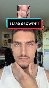How to Grow Bad Bunny Beard