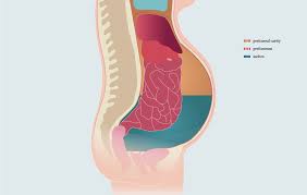 Human rib cage with lungs anatomy flat vector illustration. Pleural Effusion And Ascites Pfm Medical Ag