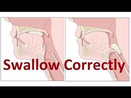 Tips And Exercises On Improving Incorrect Swallowing By Prof John Mew Jaw Exercises Myofunctional Therapy Singing