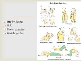 spondylosis