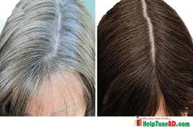 Can you tell me how to convert white hair into black naturally? à¦¸ à¦¦ à¦š à¦² à¦• à¦² à¦•à¦° à¦° à¦˜à¦° à¦¯ à¦‰à¦ª à¦¯ Convert White Hair Into Black Hair