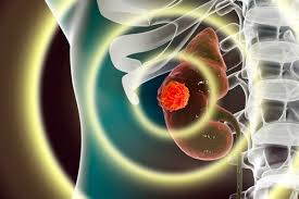 A Renal Mass In A Solitary Kidney Initial Management Options