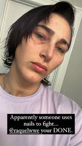 Creative Rhea Ripley Tattoo Ideas For Fans-nationalemergingartprize