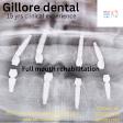 Full mouth rehabilitation product image