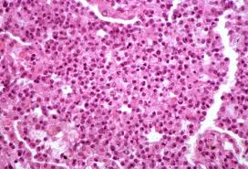Image result for Mycoplasma
