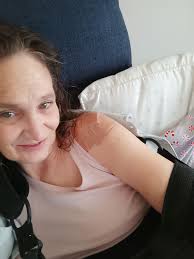 Shoulder Surgery Recovery Day 1 Experiences and Advice