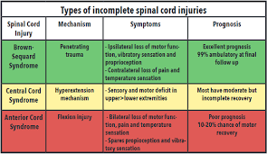 Image result for Spinal Shock