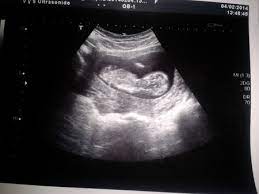 Segun Ultrasonido Estoy De 14 Semanas Bebes De Agosto 2014 Felices 4 Anitos A Todos Los Bebes Babycenter