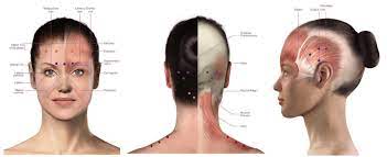 Botox is available for chronic migraine sufferers under the pbs scheme and medicare. Botox For Migraine Migrainepal