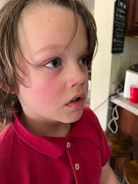 Why no homecoming in Marshall County schools?