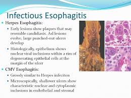 Using medications, bodily infections, and exposure to stomach acid are. Disorders Of The Esophagus Ppt Video Online Download
