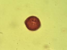 Image result for Bridelia mollis