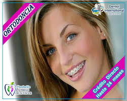 📣📣ORTODONCIA SIN ENTRADA📣📣 😁Es tu oportunidad para renovar tu  sonrisa😉 ☎️Reserva tu cita al 2528-115 o al 099-899-2792📲 🏥Av. Pérez  Guerrero Oe3-66 y Versalles, sector Universidad Central 💳ACEPTAMOS TODAS  LAS TARJETAS DE