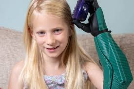 Girl, 7, born without a hand can brush hair with new bionic arm