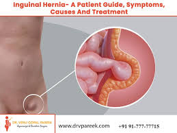 Image result for Inguinal hernia child