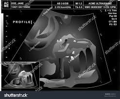 Vector Illustration Ultrasound Profile Baby View Stock Vector Royalty Free 4305541