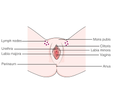 Image result for Vulvar Cancer