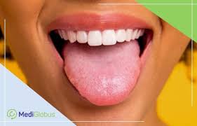 What You Need To Know About Tongue Cancer Mediglobus