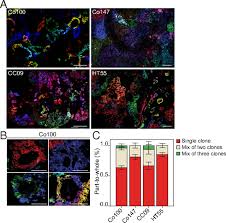 You'll find cause awareness products for almost every cause and disease here at supportstore, in stock and available to ship same business day. Spatiotemporal Regulation Of Clonogenicity In Colorectal Cancer Xenografts Pnas