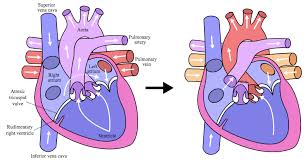 Www.openpediatrics.org openpediatrics™ is an interactive digital learning platform for. Fontan Procedure Schematic A Fontan Is Done In Most Children Approximately 90 Who