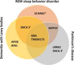 Image result for REM Sleep Behavior Disorder