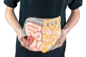 However, the truth is that constipation is among the first symptoms of colon cancer. 6 Early Warning Signs Of Colon Cancer In Men