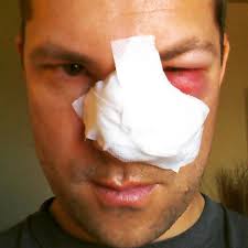 Meteorologist Damon Lane