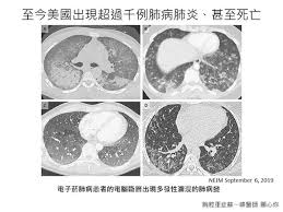 Jun 01, 2021 · 莽男的惡質行為，引發網友公憤，胸腔科醫師蘇一峰在臉書發文，「請政府嚴懲重罰，光呼籲配合醫護真的不夠，醫護前線賣命作戰，需要來自國家社會法規更多的支持！ è˜‡ä¸€å³° é›»å­è¸çœŸçš„å®‰å…¨å—Ž è¡ŒéŠ·è©±èªžçš„çœŸç›¸æ˜¯å¦‚ä½• é›²è«– Ettodayæ–°èžé›²