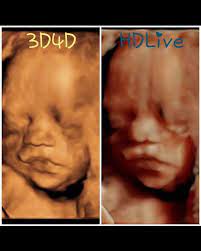 Baby Bliss Ultrasound Llc Home Facebook