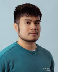 My name is Abby and I spent most of my life feeling ugly, insecure and  incomplete. I hid under hats, scarves and wigs because of my Alopecia, a  hairloss condition that has