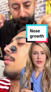 Hope that clarifies things! 😃 #confusing #bizarre #explained #medical  #doctor #doctorreacts #nose #skin #wart