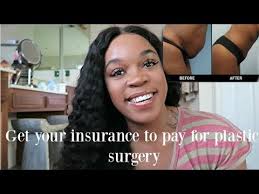 Maybe you would like to learn more about one of these? How To Get Your Insurance To Cover Plastic Surgery After Weight Loss Kisha Rose Youtube