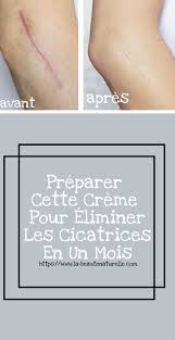 Pin On Attenuer Les Cicatrices