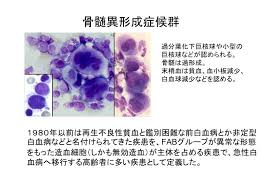 Aml 1st and 2nd cr, all 1stcr , cml cp ＊highrisk : Http Www Hoku Iryo U Ac Jp Mkobaya Kobayashi Internal Medicine For School Of Psychological Science Files Lecture 20notebook 203 Pdf