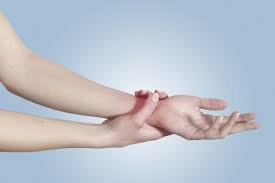Wrist sprains are relatively common injuries, especially among athletes. Is My Wrist Broken Or Sprained Arora Hand Surgery Nerve Flossing Flossing Sprained Wrist