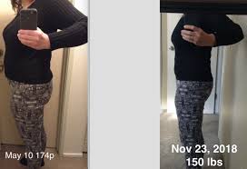 Hypothyroid In Photos Before And After Hypothyroidism Thyroid Health Blog
