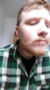 There's also a belief, based mostly on anecdotal evidence, that coconut oil stimulates hair growth. Coconut Oil Beard Board