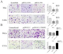 Although studies indicate that people with diabetes suffer more frequently from cancer, men with diabetes do not increasingly. Plos One Overexpression Of Trop2 Predicts Poor Prognosis Of Patients With Cervical Cancer And Promotes The Proliferation And Invasion Of Cervical Cancer Cells By Regulating Erk Signaling Pathway