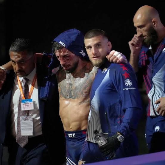 Ilia Topuria taken to hospital as images of injuries show face disfigured after UFC White House beating | talkSPORT
