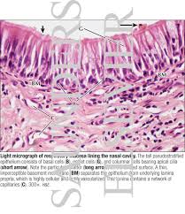 They also affect how your voice sounds nasal cavity and sinus tumors are usually treated with surgery. Light Micrograph Of Respiratory Mucosa Lining The Nasal Cavity