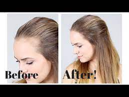 Daily hairstyles for reducing reclining hairline female : How To Hide Recession In Your Hair Line Youtube