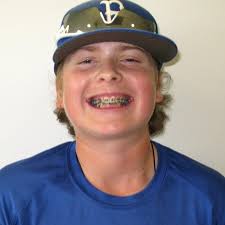 Michael J. Fillman, DDS, MS (@fillmansmiles) • Instagram photos and videos